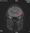 CHỌN protocol MRI NÀO CHO PHÙ HỢP?